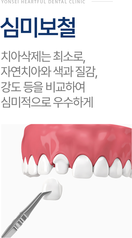 심미보철