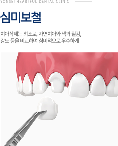 심미보철